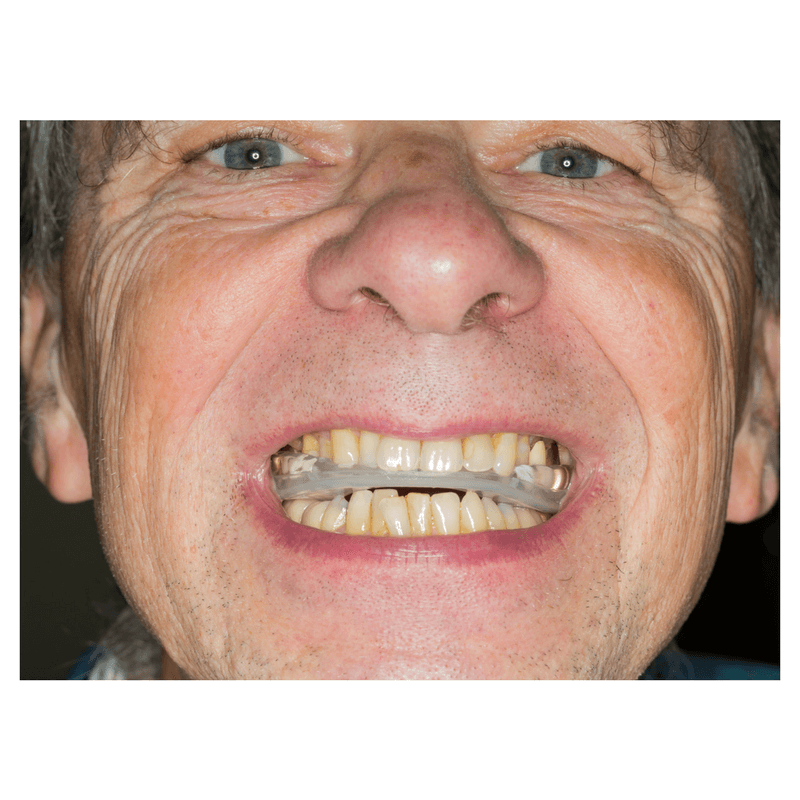 mature man grinding his teeth