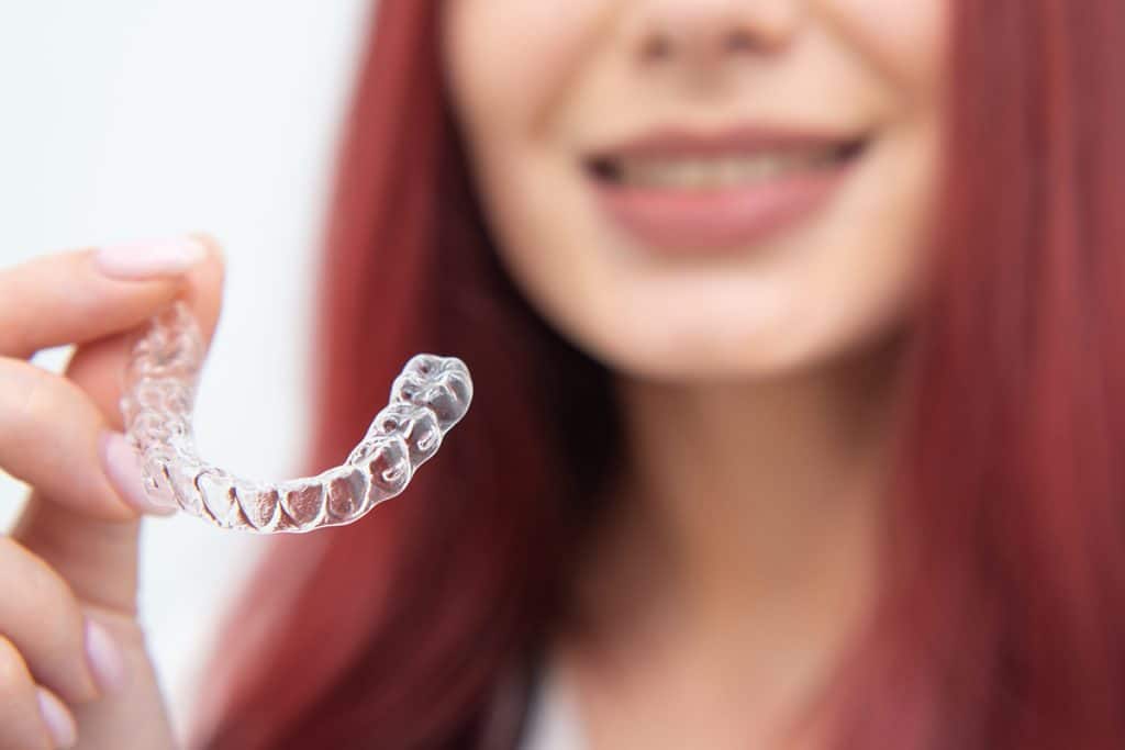 How Long Does Invisalign Take to Straighten Teeth? Smile Shack