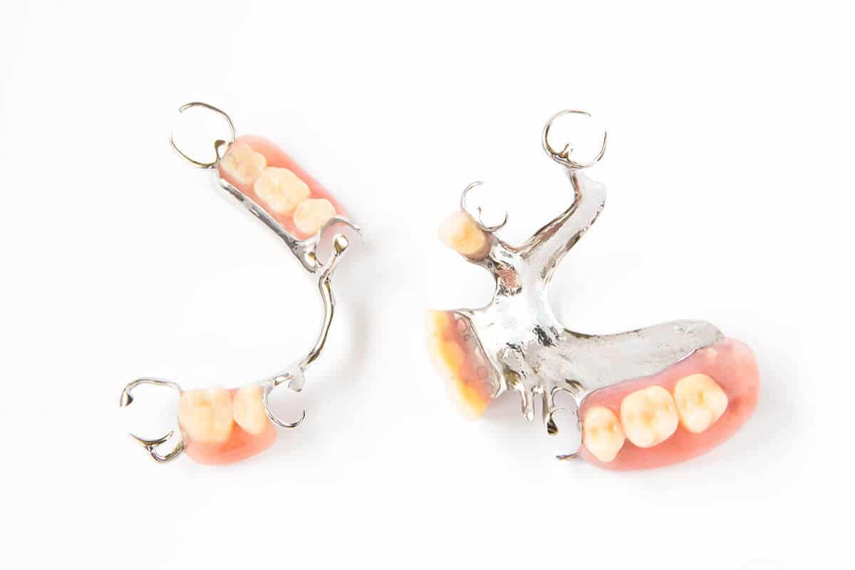 models of partial dentures